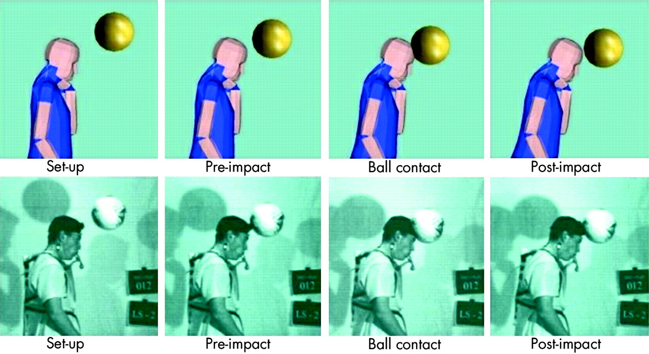 What happens to the brain during soccer heading?